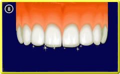 Prophylaxe - Behandlungsziel: saubere, gesunde Zähne